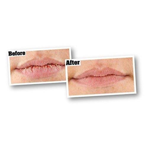 Original Lip Repair Lip Balm Beauty & Health O'Keeffe's 