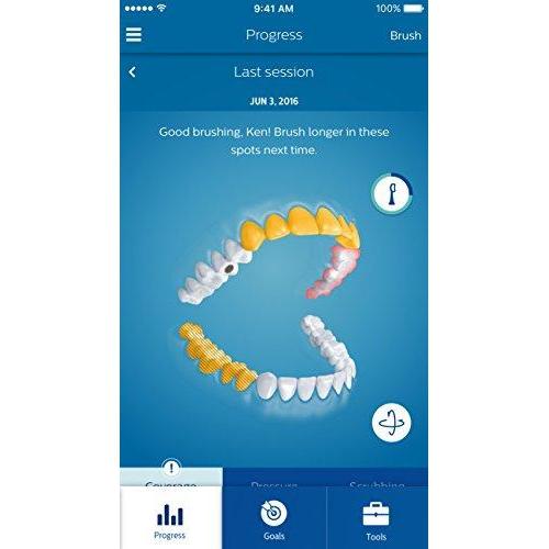 Philips Sonicare DiamondClean Smart Electric, Rechargeable toothbrush for Complete Oral Care – 9300 Series, Black, HX9903/11 Electric Toothbrush Philips Sonicare 