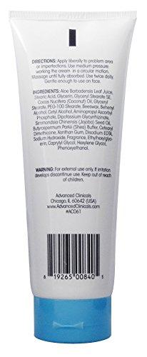 Advanced Clinicals Dark Spot Therapeutic Cream with Vitamin C. Hydroquinone Free. For Age Spots, Blotchy Skin. Face, Hands, Body. Large 8oz Tube. Skin Care Advanced Clinicals 