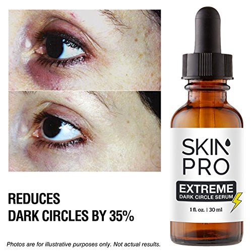 Dark Circle Eye Cream | SkinPro Extreme Under Eye Serum | 35% Reduction in Dark Circles Under the Eyes & Under Eye Puffiness | Medical Grade with Regu-Age Patented Peptide Skin Care SkinPro 