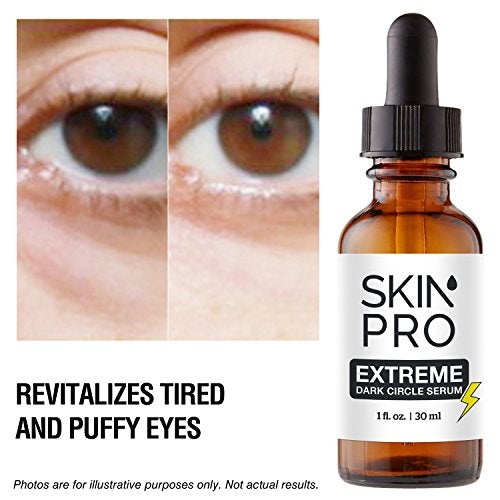Dark Circle Eye Cream | SkinPro Extreme Under Eye Serum | 35% Reduction in Dark Circles Under the Eyes & Under Eye Puffiness | Medical Grade with Regu-Age Patented Peptide Skin Care SkinPro 