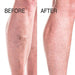 Advanced Clinicals Vein Care- Eliminate The Appearance of Varicose Veins. Spider Veins. Guaranteed Results! (Two - 8oz) Skin Care Advanced Clinicals 