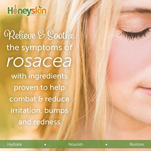 Gentle Moisturizing Organic Face & Body Wash (4 oz) Manuka Honey, Eczema, Psoriasis, Acne, Rosacea, Aloe Vera, Botanicals, No Parabens, No Sulfates, No Fragrance, Non-Allergenic by Honeyskin Skin Care Honeyskin Organics 