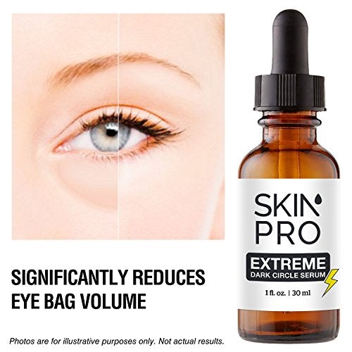 Dark Circle Eye Cream | SkinPro Extreme Under Eye Serum | 35% Reduction in Dark Circles Under the Eyes & Under Eye Puffiness | Medical Grade with Regu-Age Patented Peptide Skin Care SkinPro 