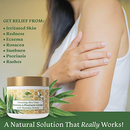 Amazing Aloe Vera Eczema and Psoriasis Cream with Manuka Honey by Green Leaf Naturals - 4 oz Skin Care Green Leaf Naturals 