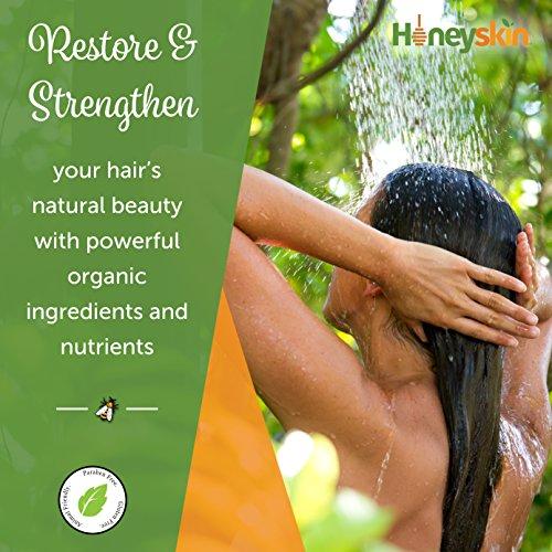 Gentle Restorative Conditioner (16 oz) Repairs & Soothes Itchy Dry Scalp, Seborrhea, Eczema, Psoriasis, Prevent Hair Loss, Natural Ingredients for Vibrant Healthy Hair & Scalp by Honeyskin Organics Hair Care Honeyskin Organics 