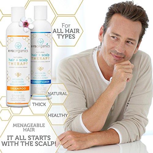 Argan Oil Conditioner for Dry, Itchy Scalp & Dry, Damaged, Frizzy Hair (8oz) Natural Hair Conditioner for Dandruff, Scalp Psoriasis, Eczema & More for Men, Women & Kids. Sulfate Free, Ph Balanced Hair Care Era Organics 