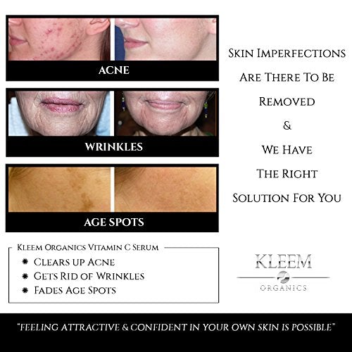 Anti Aging Serum Set of 2 Vitamin C Serum for Women and Men with Pure Organic Ingredients. Triple Anti Aging Facial Treatment: Wrinkle Reducer - Age Spot Remover – Collagen Booster Skin Care Kleem Organics 
