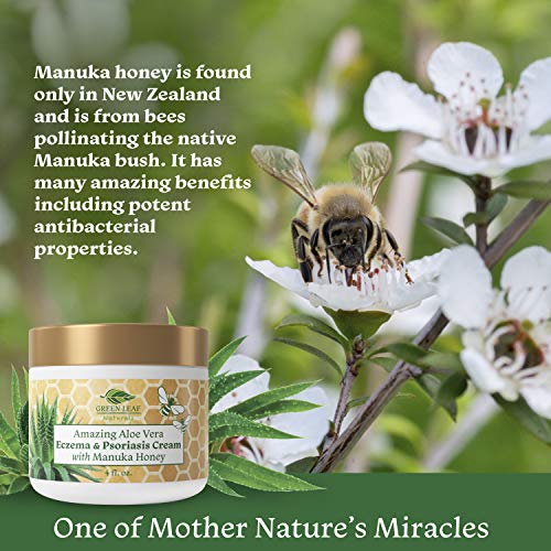 Amazing Aloe Vera Eczema and Psoriasis Cream with Manuka Honey by Green Leaf Naturals - 4 oz Skin Care Green Leaf Naturals 