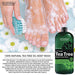 Antifungal Tea Tree Oil Body Wash – HUGE 16 OZ – 100% Pure & Natural - Extra Strength Professional Grade - Helps Soothe Toenail Fungus, Athlete Foot, Body Itch, Jock Itch & Eczema Skin Care New York Biology 