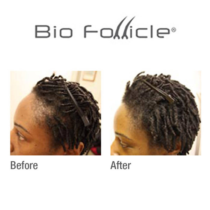 (HSS) Dry Hair Treatment Spray Hair Care Bio Follicle 