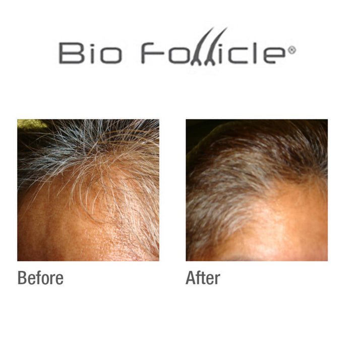 (HSS) Normal Hair Treatment Spray Hair Care Bio Follicle 