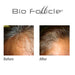 (HSS) Normal Hair Treatment Spray Hair Care Bio Follicle 